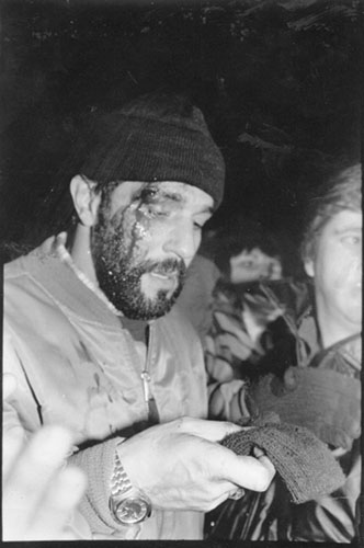 filtro94-herido.jpg (41702 bytes)